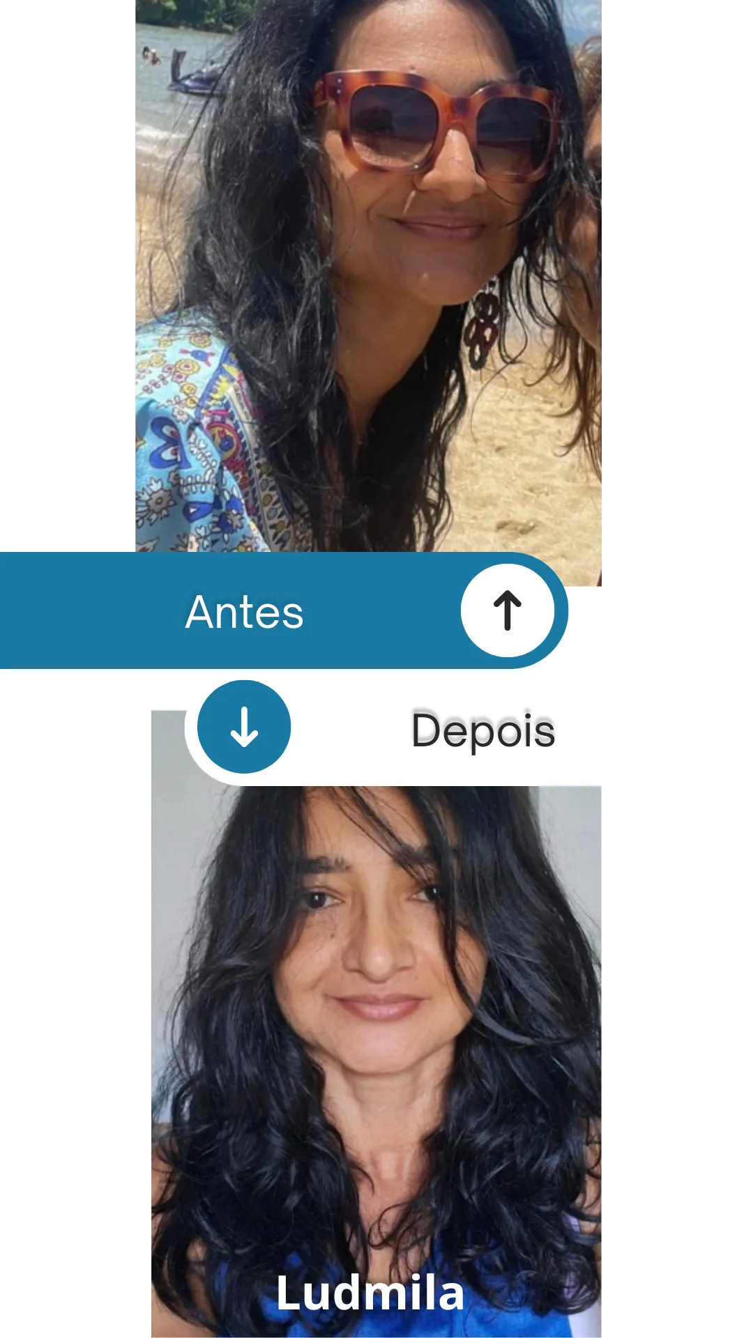 Gray Minimalist Skincare Before and After Instagram Story - 10