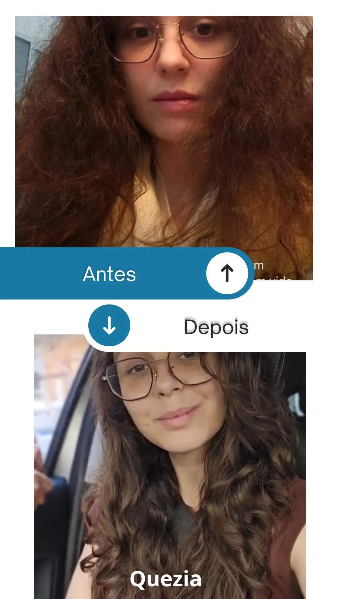 Gray Minimalist Skincare Before and After Instagram Story - 3